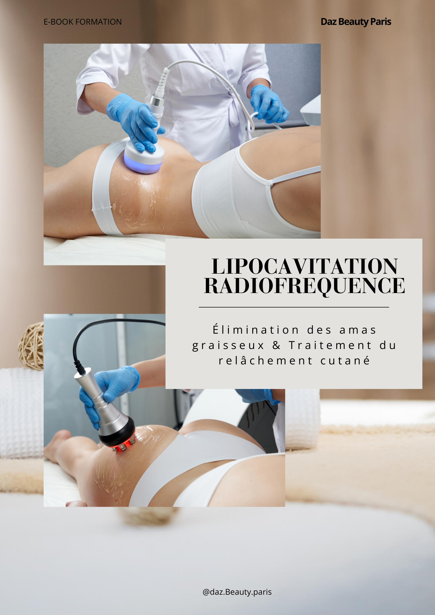 E-book formation Lipocavitation / Radiofréquence