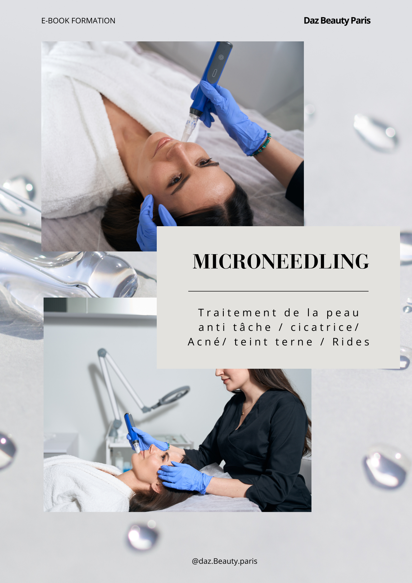 E-book Formation Microneedling / cernes